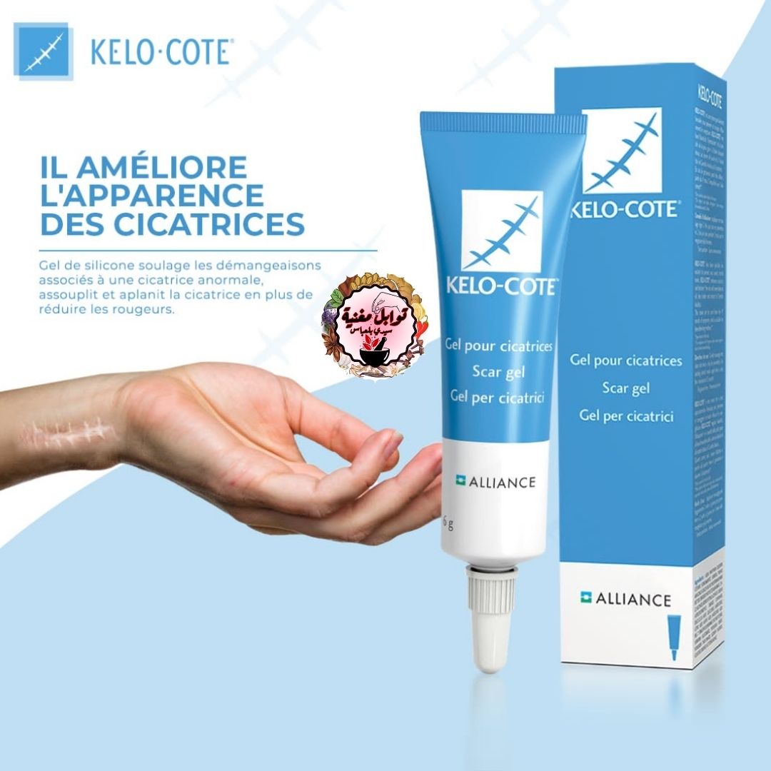 Kelo-Cote